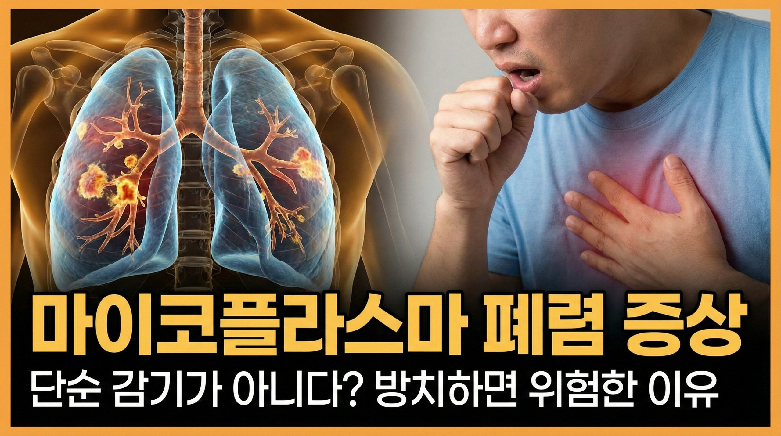 마이코플라스마 폐렴 증상 및 폐 엑스레이 소견 안내 이미지